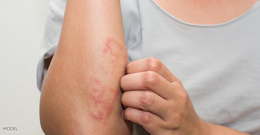 Stress Triggers Skin Problems: Dermatologists Offer Helpful Management Advice